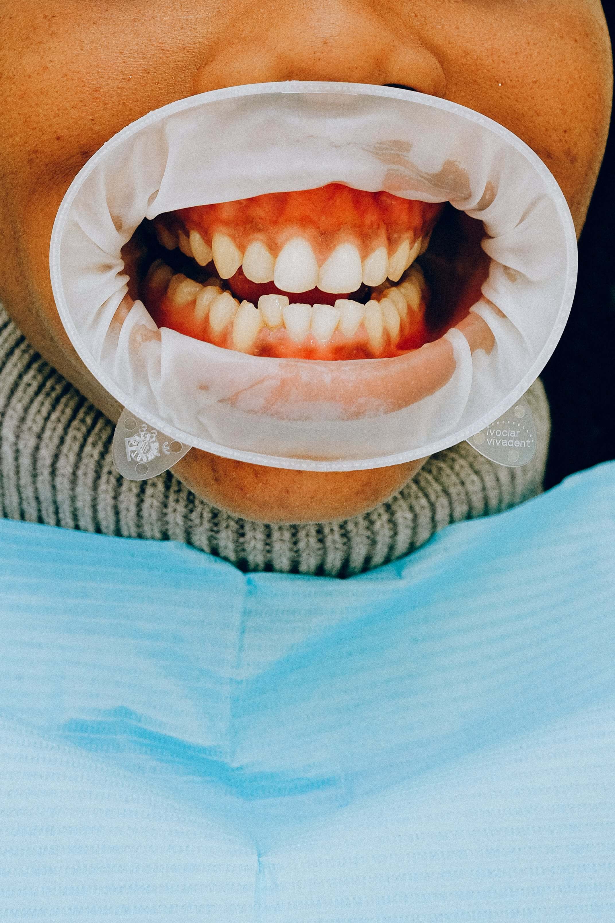 잇몸질환