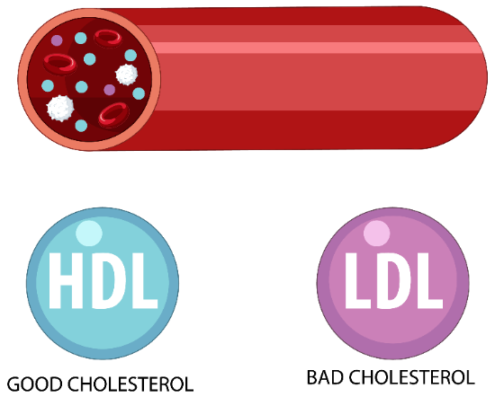 LDL(나쁜) 콜레스테롤이 증가하고 HDL(좋은) 콜레스테롤이 감소