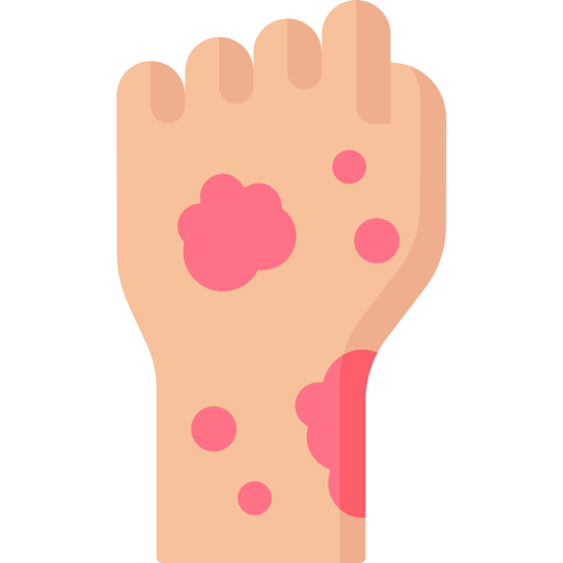 피부발진 종류 피부발진 원인 피부 붉은발진