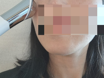에이지알_ATS_에어샷_사용중모습