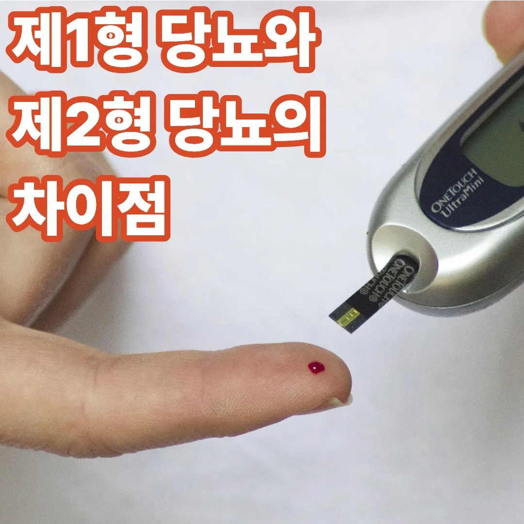 제1형 당뇨와 제2형 당뇨의 차이점