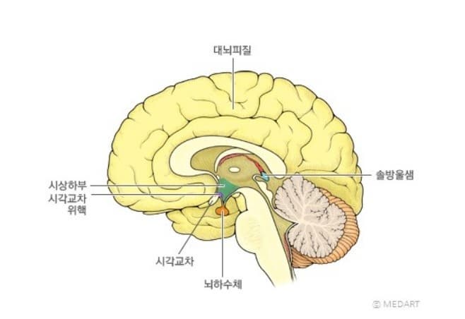 송과선 위치