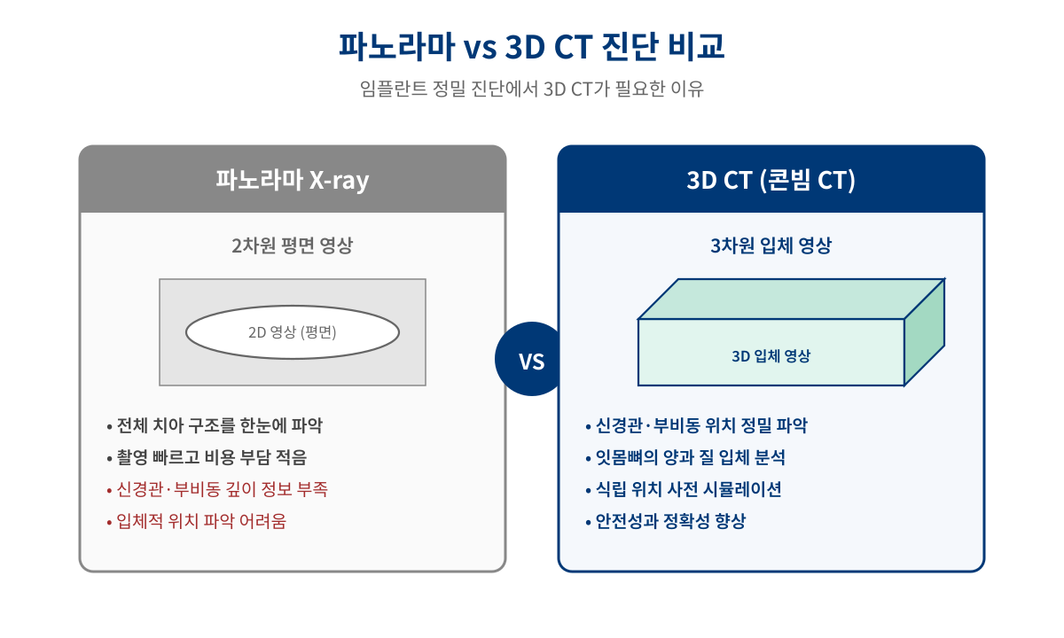 파노라마 X-ray와 3D CT 비교 - 임플란트 진단 정확도 차이