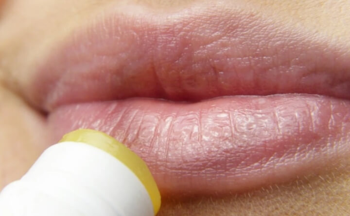 입술 부르트지 않는 방법