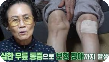퇴행성 관절염