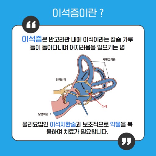 이석증의 증상