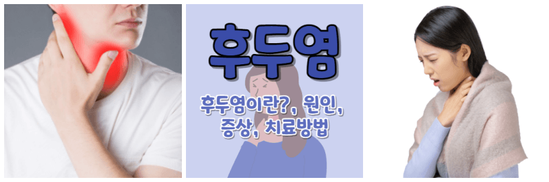 후두염 사진 3개