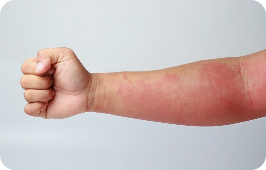 간수치가-높으면-나타나는-증상