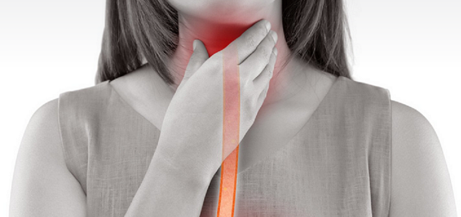 역류성 식도염 사진