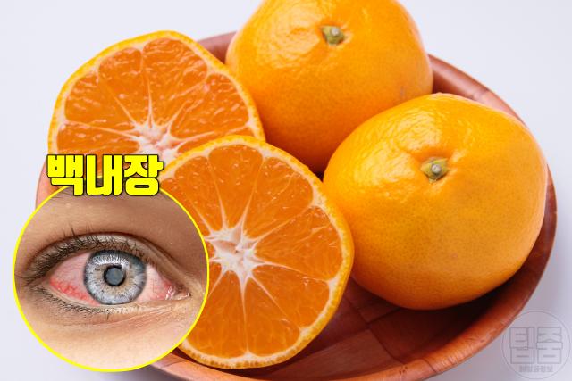 눈에 좋은 비타민 많은 음식 비타민c 비타민e 오렌지 귤