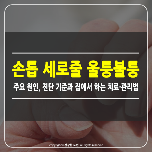 손톱 세로줄 울퉁불퉁 썸네일