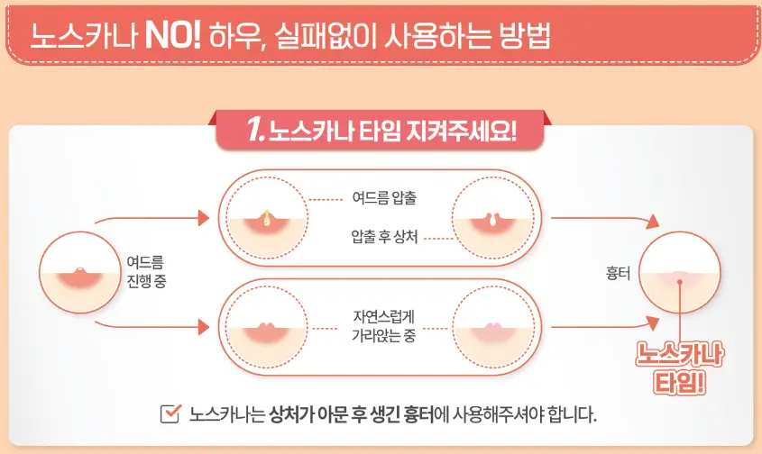 노스카나-겔-사용법