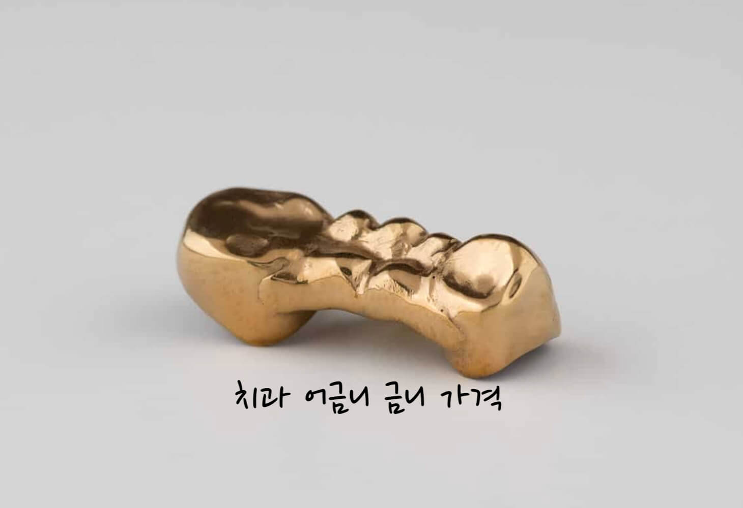 치과 어금니 가격