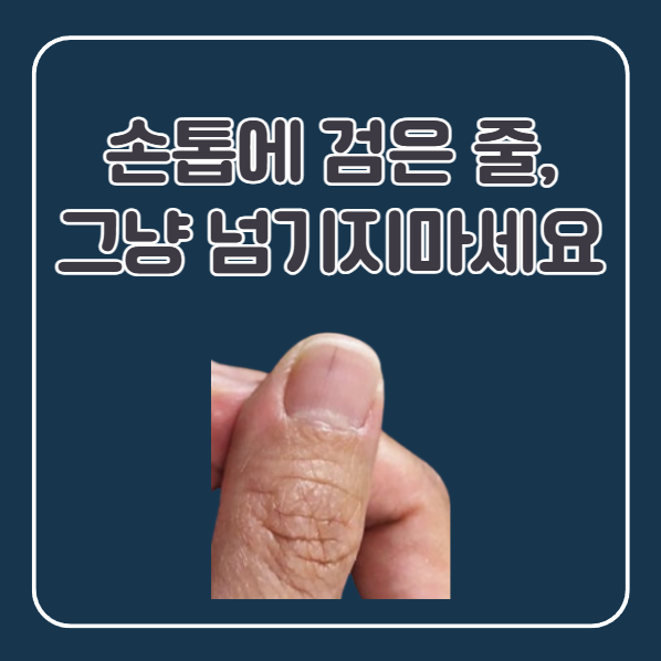 손톱 검은 세로줄 생기는 이유와 손톱 색깔로 내 건강상태 보는 법