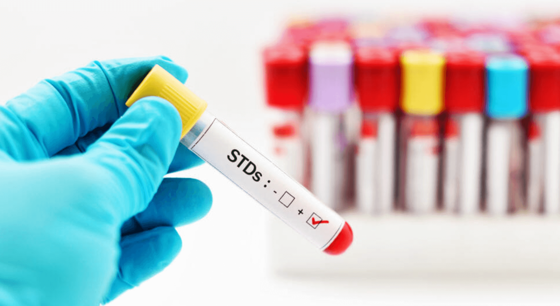 남자-성병-검사-std