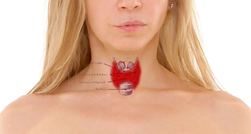 갑상선 기능 저하증 합병증