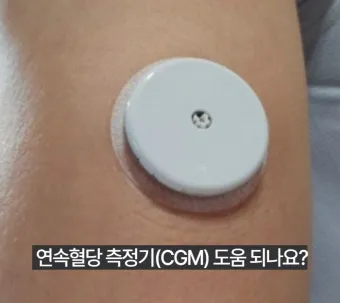 혈당측정기 선물 채혈기 시험지 보관통 간편성과 정확도를 모두 잡는 선택법_14