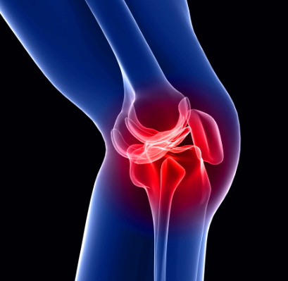 무릎 연골 손상 치료