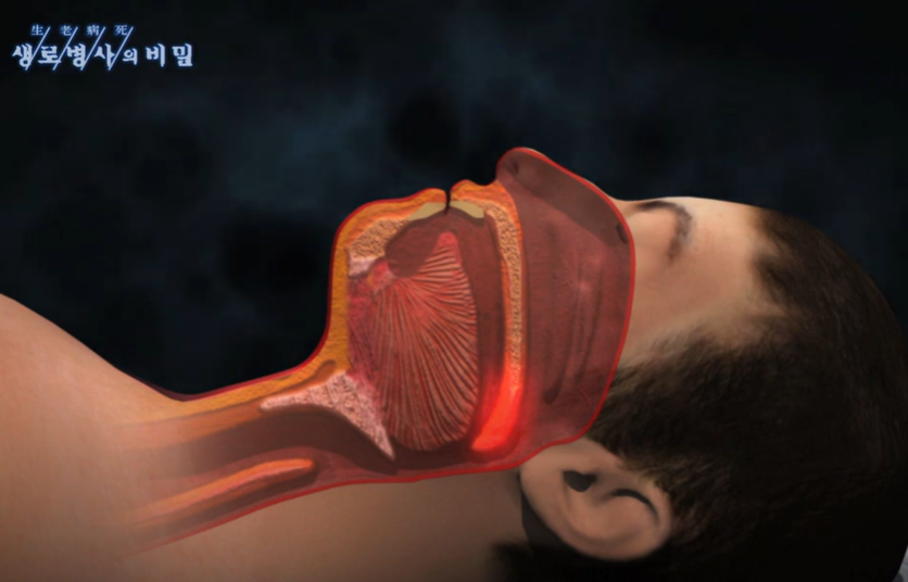 코골기 발생 중