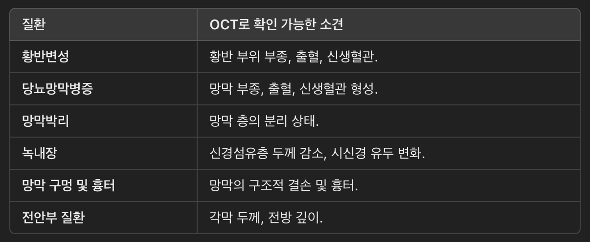 광간섭 단층 촬영 (OCT, Optical Coherence Tomography)