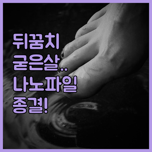 뒤꿈치 굳은살 고민 해결하는 나노 글..