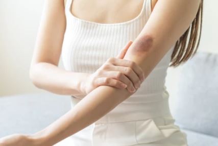 멍이 생기는 이유?