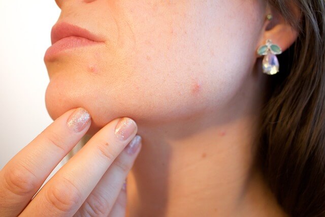 Pores-Skin-care