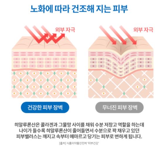 히알루론산 잘 고르는 3가지 팁