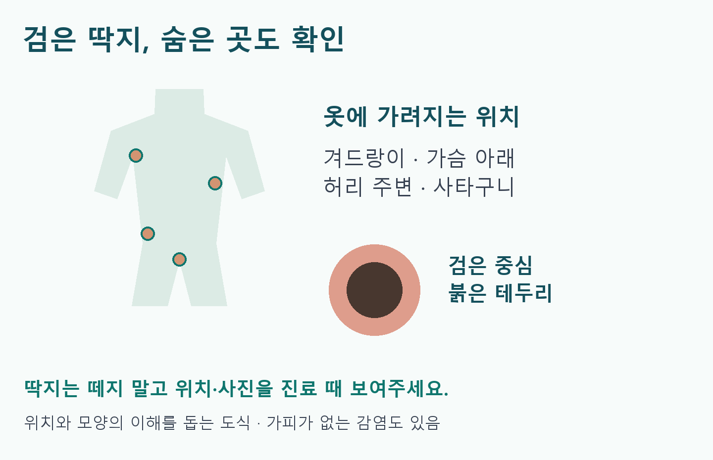 얼굴 없는 중립 몸통 도식에 겨드랑이&middot;가슴 아래&middot;허리&middot;사타구니 위치를 표시. 확대 피부 도식은 검은 중심과 붉은 테두리를 설명. 딱지는 떼지 않고 위치&middot;사진을 진료에 활용.