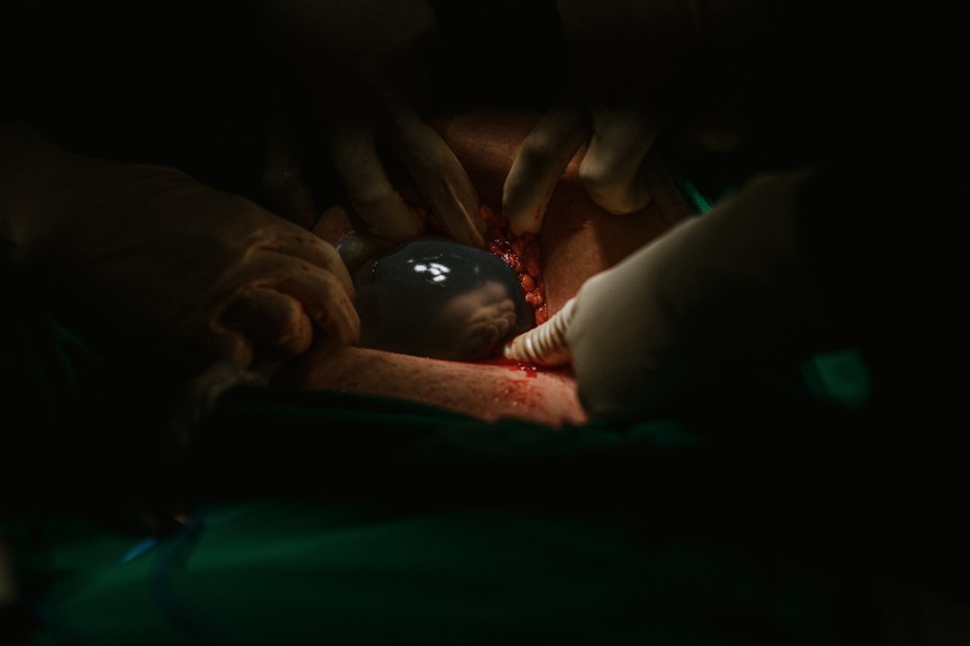 Childbirth.