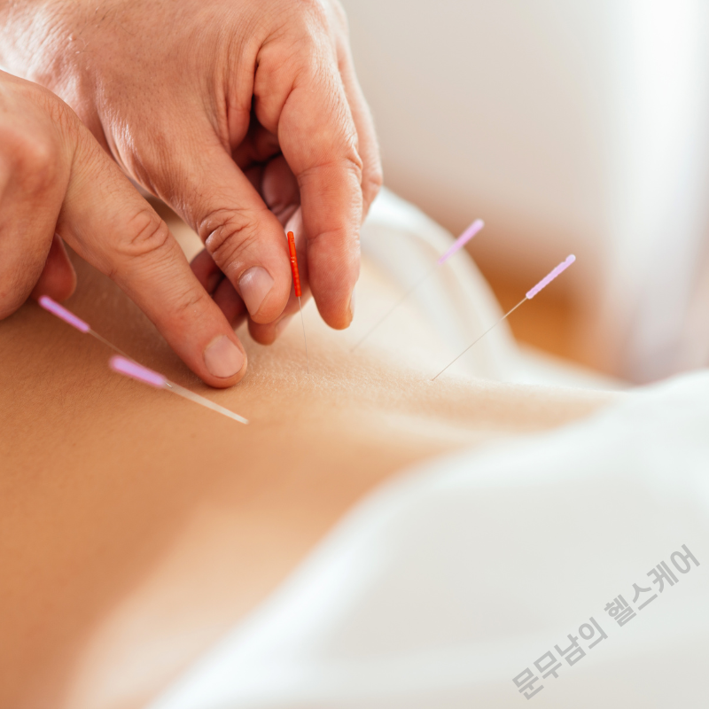 척추 분리증 증상과 치료법