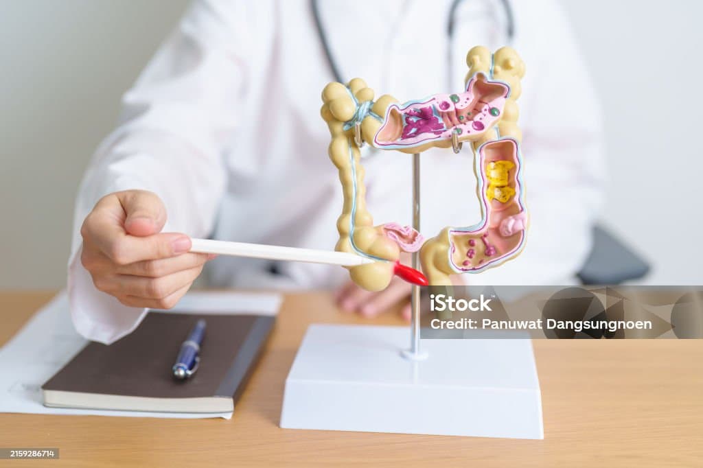 IBS와 장 건강의 관계