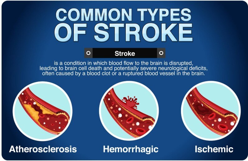 혈관에 끼어 있는 찌꺼기들