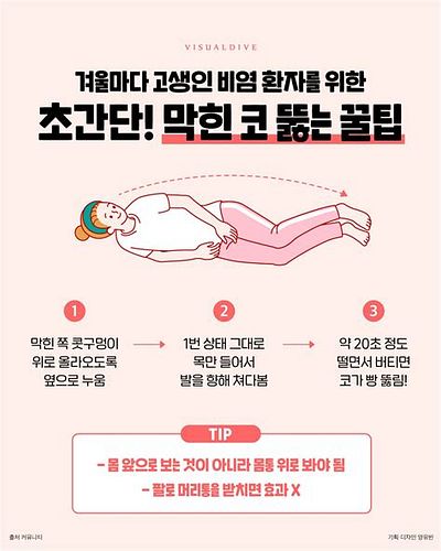 비염코막힘