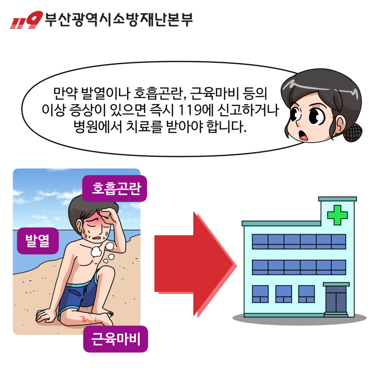 해파리 쏘였을때 관련 이미지2