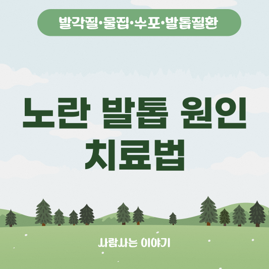 노란 발톱 원인, 무좀일까? 올바른 치료법