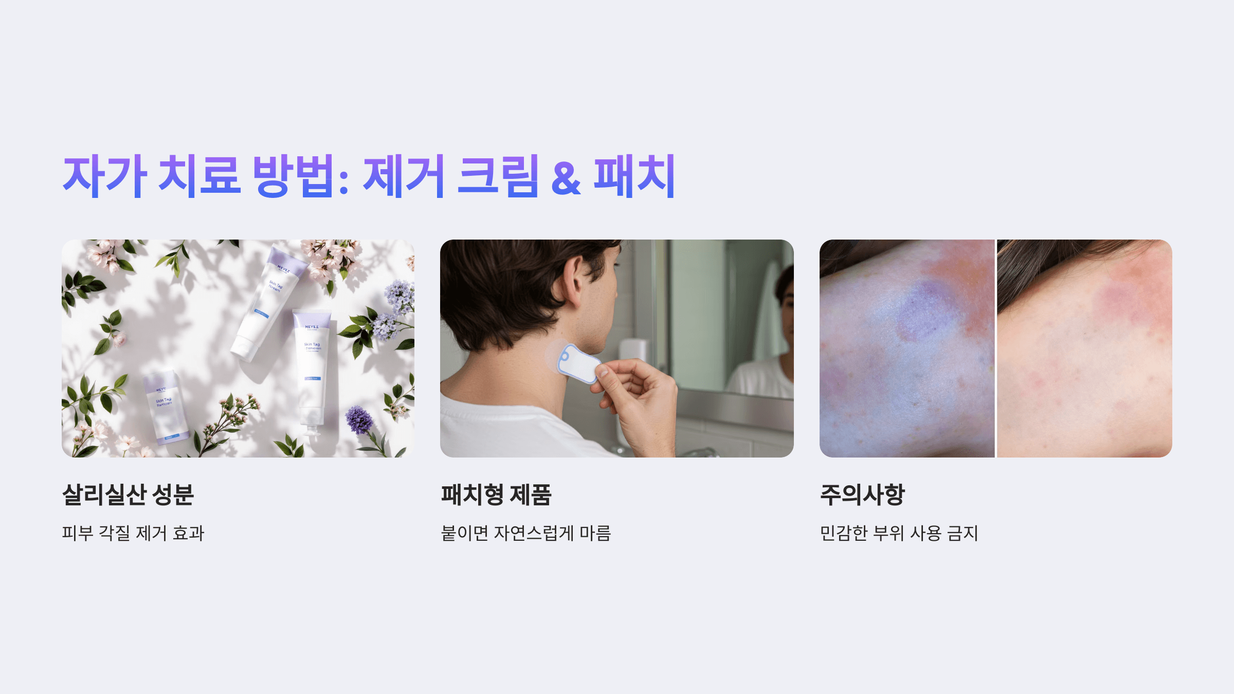 쥐젖과 관련된 사진입니다.