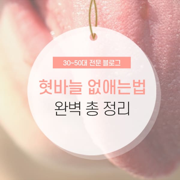 혓바늘 돋는 이유 및 없애는법 소개