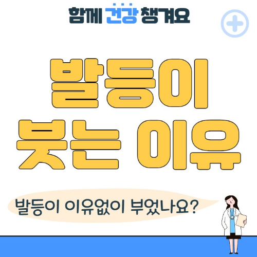 발등이 붓는 이유와 해결방법