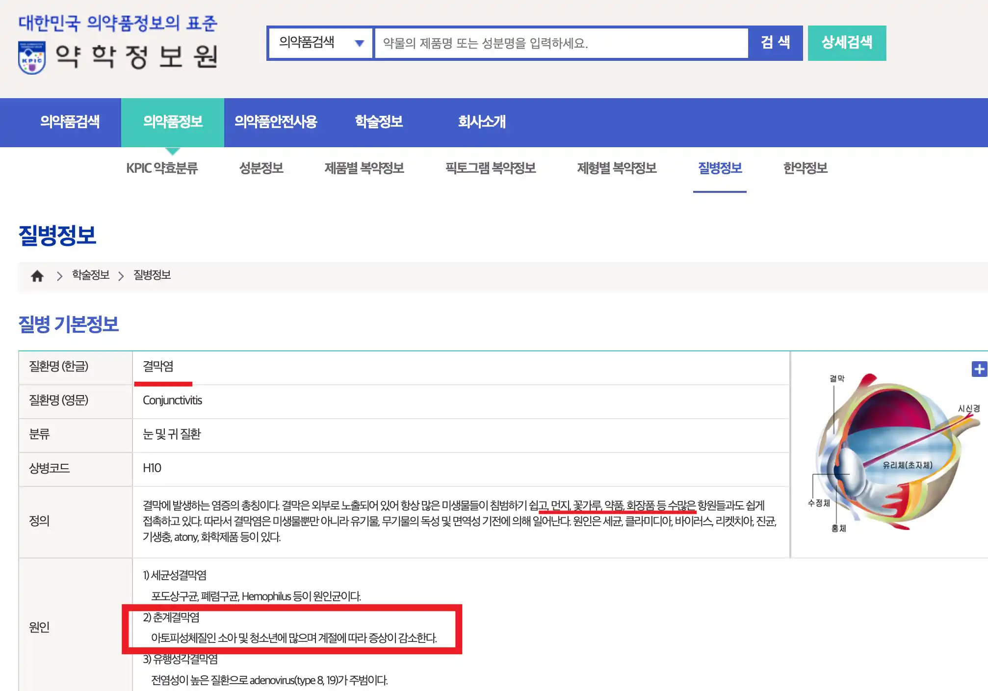 약학정보원 알레르기결막염 정보