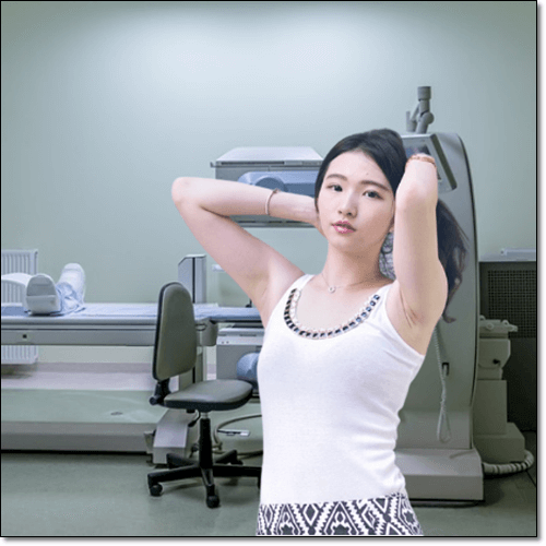 겨드랑이낭종 치료 여성