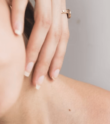 구안와사 초기증상 - 안면 비대칭