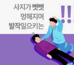 뇌전증 증상 2