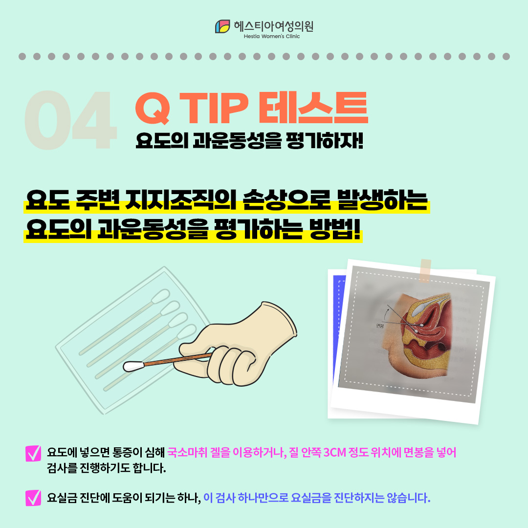 요실금 검사 네번째, Q-TIP 테스트