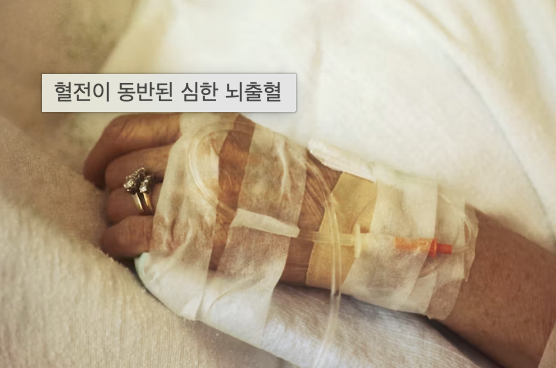 급성구획증후군 정형외과 응급 진단 치료