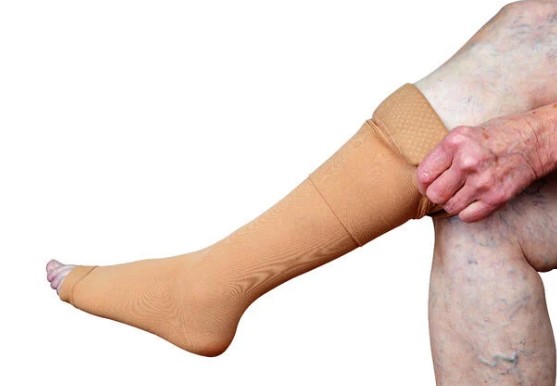 하지정맥류 초기증상과 경고신호 하지정맥류 원인 압박스타킹 효과