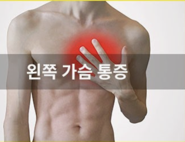 왼쪽 가슴 통증 원인