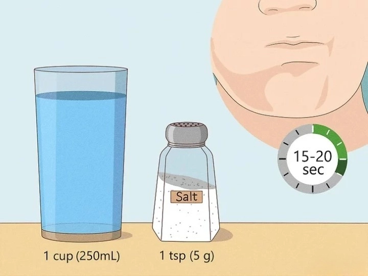 혓바늘이 돋는 이유 원인과 혓바늘 없애는 방법 꿀 치료법 자주돋는 현상