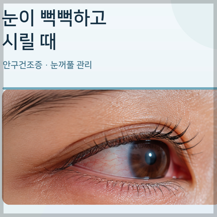 눈이 뻑뻑하고 시릴 때