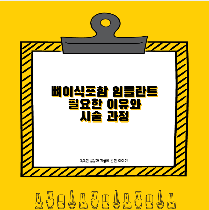 뼈이식포함 임플란트 필요한 이유와 시술 과정